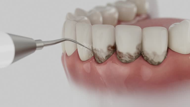 Reliable Root Canal Treatment contractor in Dickinson County County, IA by Dentist Open Now